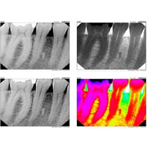 Digital Radiography